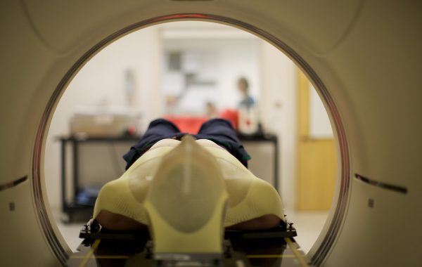 MRI scan