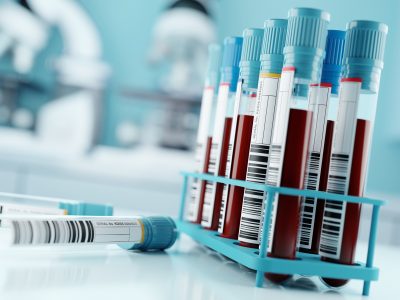 Blood samples in tubes