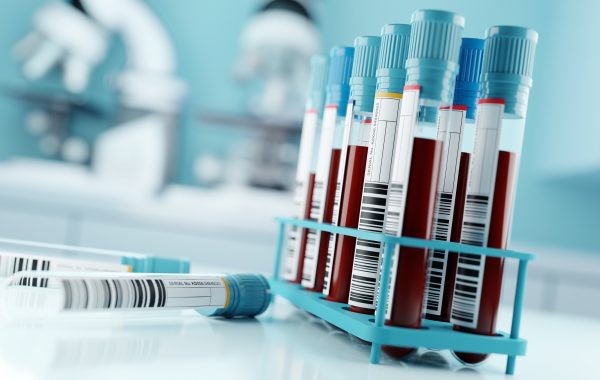 Blood samples in tubes